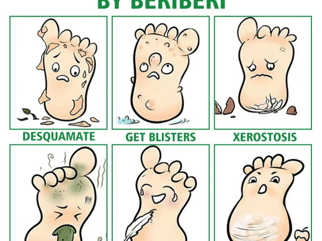 Beribéri Fungus Spray, Pharmacie - Suppléments, Conakry