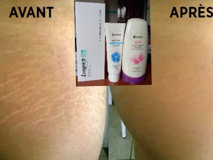 Différents Cosmétique Longrich, Parfumerie - Cosmétique, Conakry