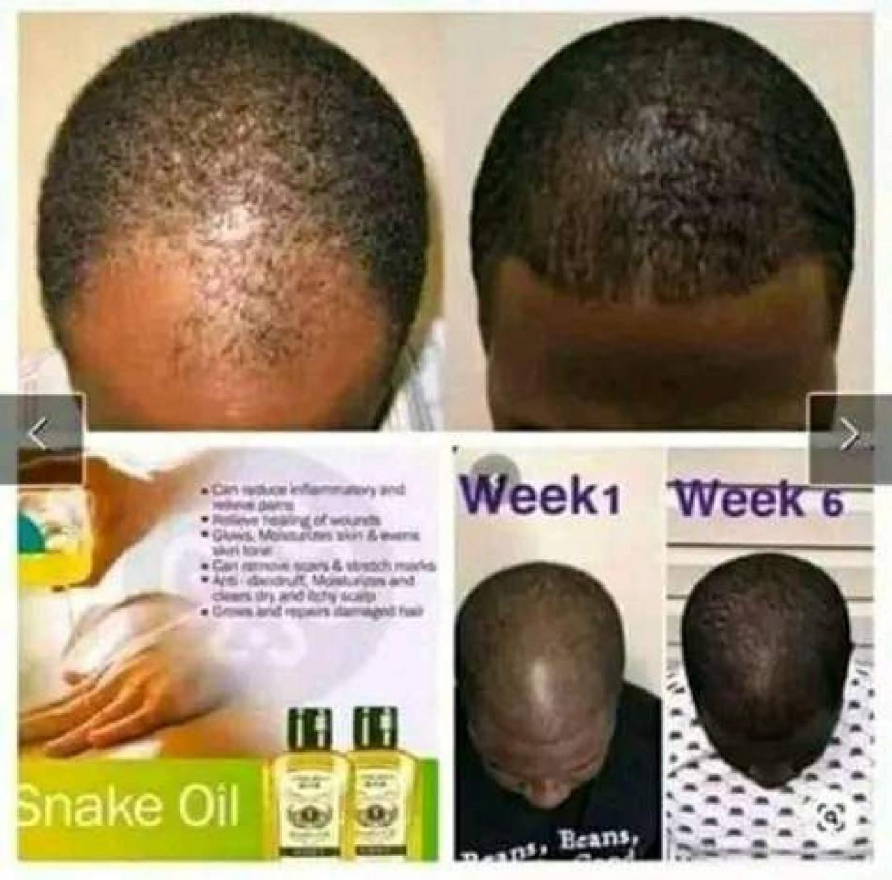 Snaik oil cheveux, Parfumerie - Cosmétique, Conakry